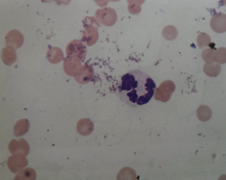 Cytologie rode bloedcellen